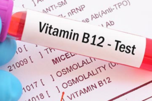 Serum B12 test