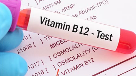 Serum B12 test