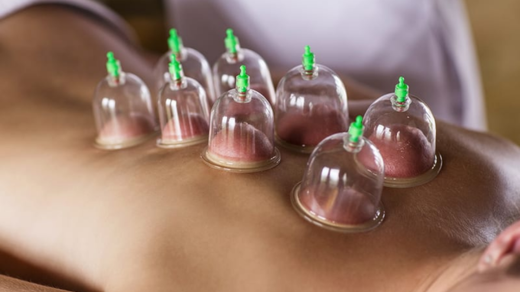 what is cupping therapy