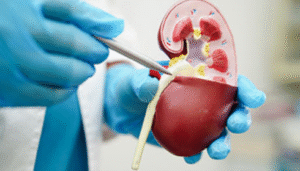 best urology hospital in bangalore